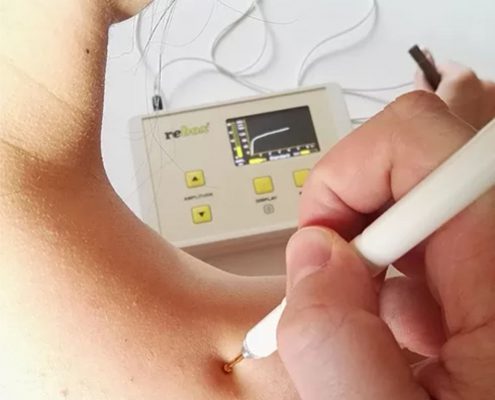 Reboxová terapie Rebox je vysoce účinný ve srovnání s jinými metodami fyzikální terapie. Princip reboxové terapie byl patentován v mnoha zemích včetně Japonska či USA.